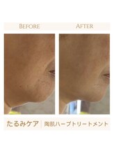 ヘブンビューティー(Heaven Beauty)/