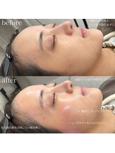 わたしいろ/肌が綺麗になるフェイスワックス