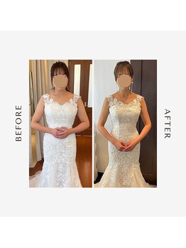 ルーチェビューティープラス(LUCE' beauty +)/ブライダルエステ