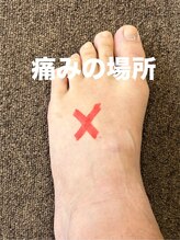 オレンジ整骨院/足の痛みセルフチェック