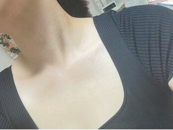 M 北千住店(の写真/【早期ケアにオススメ◎】紫外線が気になるこれからの季節だからこそ！白くて美しいお肌を目指しましょう♪