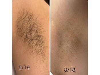 リラキュート(Rela Cute)/高校生にも大人気！