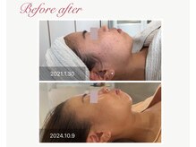 パルタージュ 三宮(Partage)/すっきりラインゲット