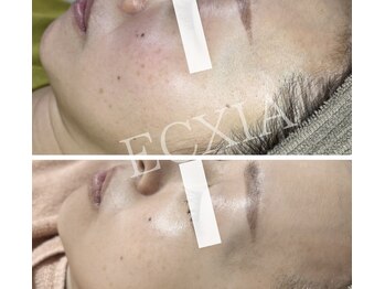 エクシア(ECXIA)/