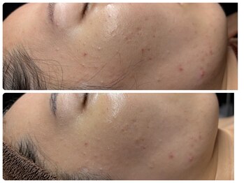 ビノスビューティー(vinos.beauty)/症例写真　レストセル