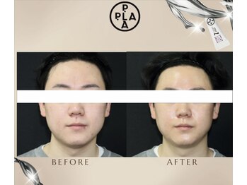 エミア(Emia)/韓国発☆プラチナ・プラピール