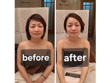 アカラ(Akala)の雰囲気(小顔矯正◎週1、4回施術 お顔もデコルテもスッキリ)