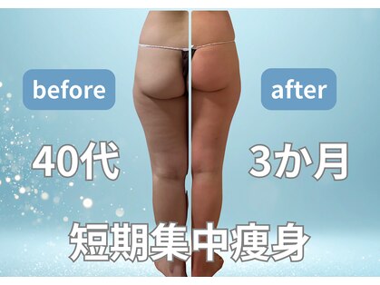 エルナ(ELUNA)の写真