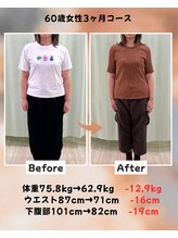 くさば整骨院/60歳女性/ダイエット3か月コース