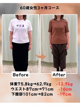 くさば整骨院/60歳女性/ダイエット3か月コース