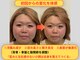 メディピークスの写真