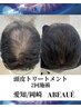 【初回限定】”まだ大丈夫”と思いながらも、頭皮が少し気になっている方へ