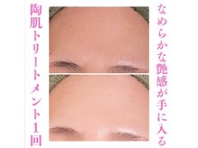 ビハニエル/【美白・キメ】なめらかな艶感