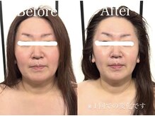 イヴトワエ(eiv Toi et A)/Before After