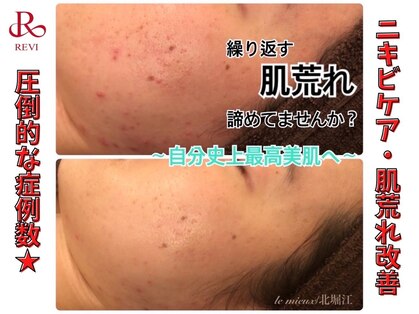 ル ミュー 堀江店(le mieux)の写真