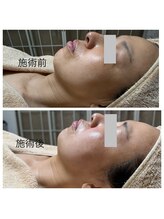 ルシアル(LUCIALL)/