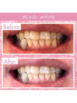 エクシア 伊勢店 サロンルナ/