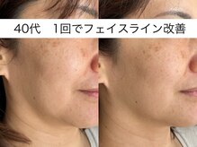 シミケア専門店 SAKURA 平塚店/ダンスレジェンドイベント部会