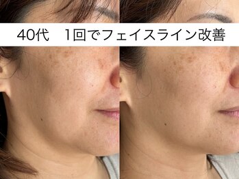 シミケア専門店 SAKURA 平塚店/ダンスレジェンドイベント部会