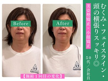 木温ノ輪/お客様の変化/小顔美容矯正