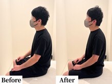 ソレア(Solea)/巻き肩・ストレートネック・猫背