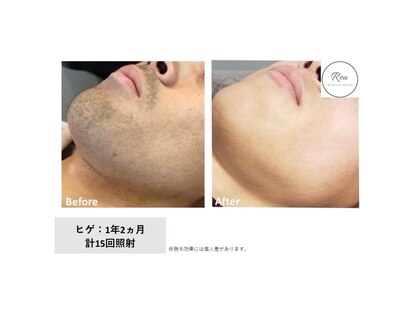 レア(Rea)の写真