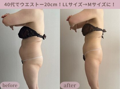 ティターニア(Titania)の写真