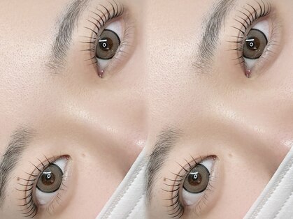 リュネル(Lunelle)の写真