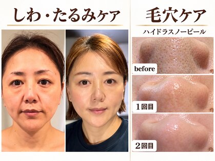 シャリオン(SHARION)の写真