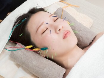 オムリス鍼灸接骨院の写真/鍼灸施術を受けてみたい方に！顔用の細い鍼使用でツボを刺激し、様々なお悩み改善◎リフトアップにも♪