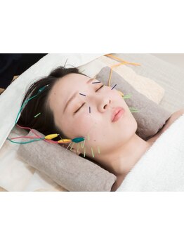 鍼灸施術を受けたい