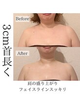 ピーチハート(Peach Heart)/黄金比小顔全身コルギ