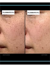 ワイケー(yk)/プラズマ×エクストリュージョン