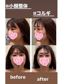 ククナドット(kukuna.)/コルギ