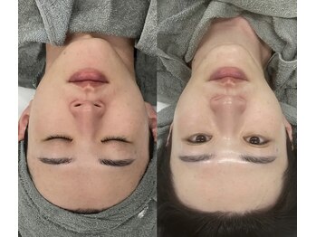 リリーラボ(LILY LAB)/【UNSTRESS/アンストレス】