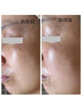 ルシアル(LUCIALL)/