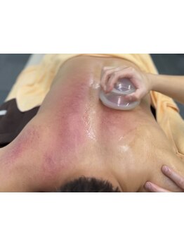 首・肩のつらさを改善したい