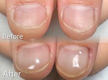 エンネイル(en.nail)/20代 女性