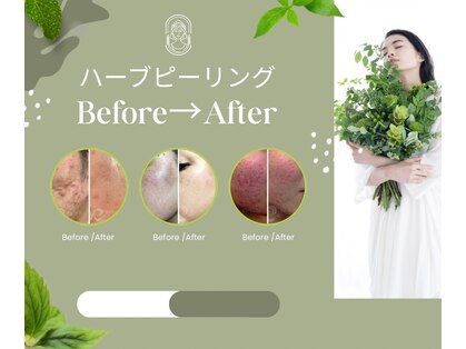 ピュアスキンラボ(PureSkinLab.)の写真