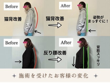 ハチ(HACHI)の写真