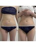 【リピーター様多数☆】ウィンバックお腹集中60分！脱ぽっこりお腹☆