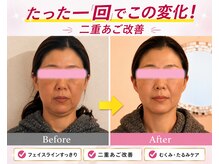 ブルーム 池袋店(Bloom)