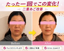 ブルーム 池袋店(Bloom)