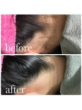 ジョエルワックス 沖縄糸満店(JOELLE WAX)/スッキリうなじ！