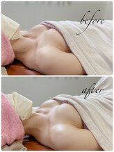 ルウ(Ruu.)/下垂にお悩みのお客様！