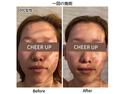 チア アップ(CHEER UP)の写真