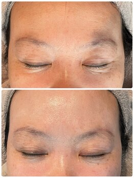 エステティックジュビラン アンビエンテ 福井南店/特殊近赤外線で肌の代謝促進