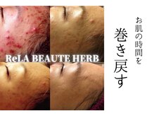 リノ トータルビューティサロン(lino total beauty salon)/ハーブトリートメント