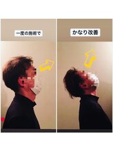 芦田整体療術院/首の凝りと痛みが消えます