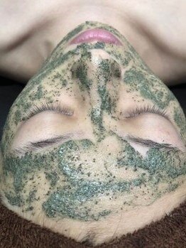 オルネ(ORNE.)の写真/剥離なしのハーブピーリング☆300種類の酵素の力で古い角質を優しく取り除き肌本来の美しさを取り戻します!
